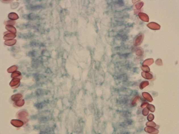 Coprinus Slides - Coprinus 05 400X